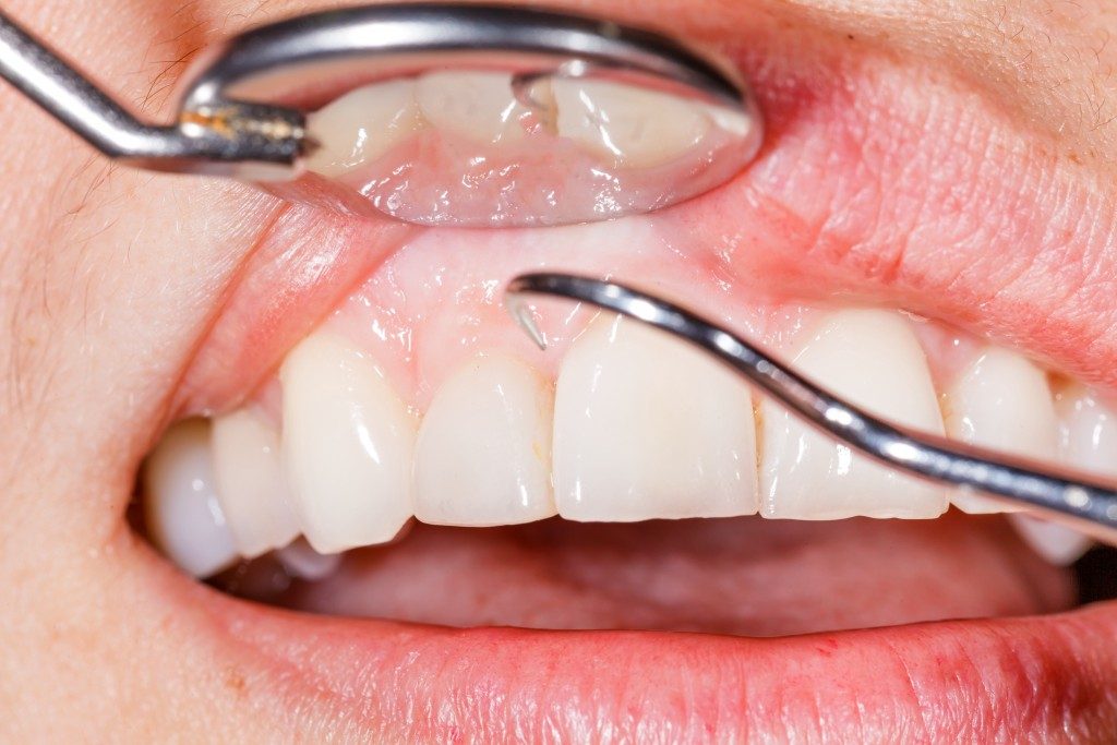 Closeup photo of a dental examination