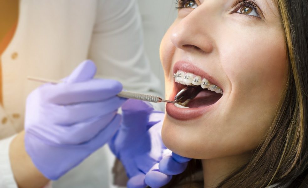 girl on dental braces check up