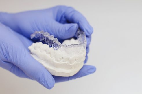 sample clear braces