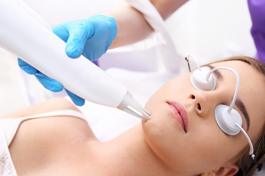 hair removal using laser