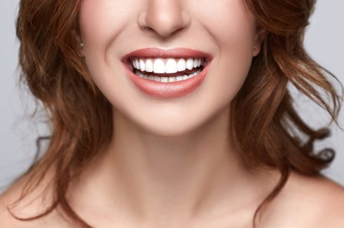 person with staright, white teeth