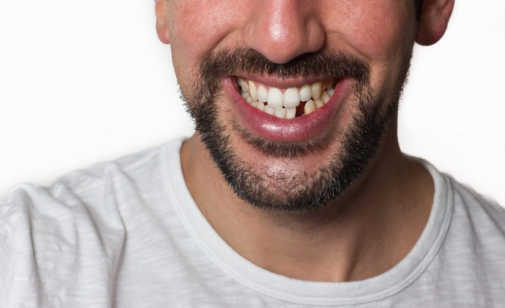 man with a missing tooth